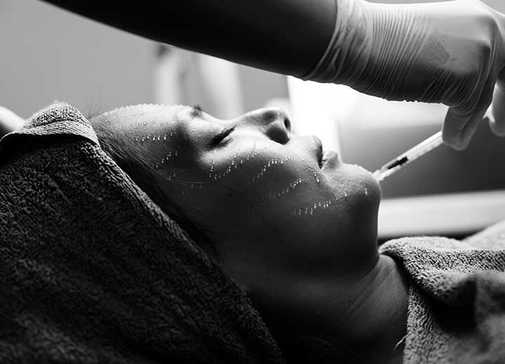 Comment se déroule une séance de skinbooster à Lyon ?